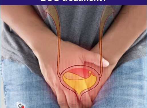 side effects of BCG treatment side effects of BCG treatment