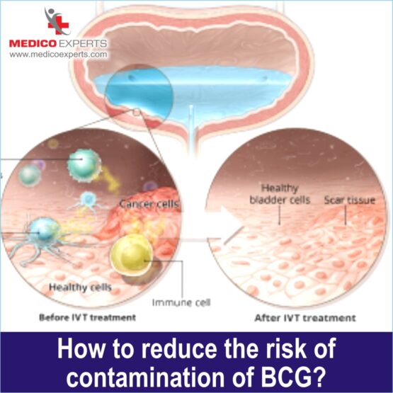 How to reduce the risk of contamination of BCG