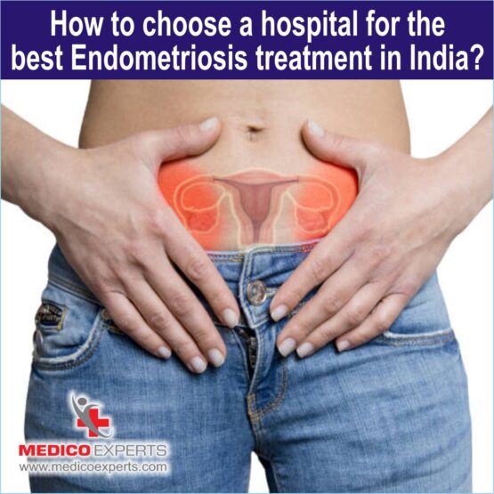 best endometriosis treatment in india,