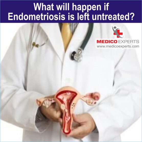 endometriosis treatment in india, endometriosis india
