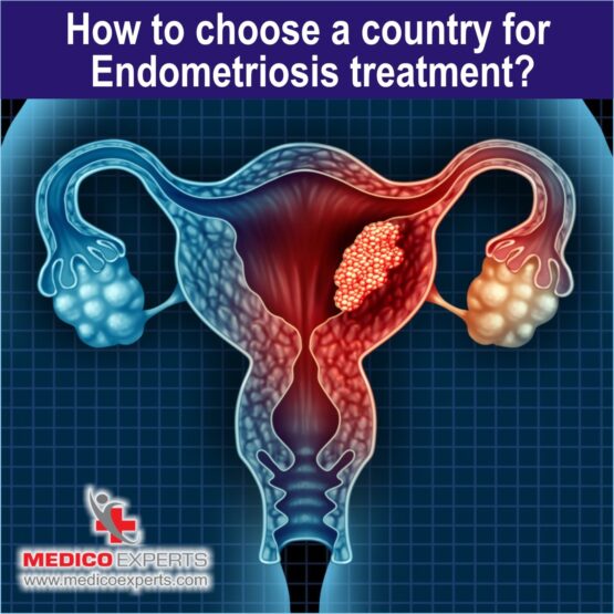 country for endometriosis treatment