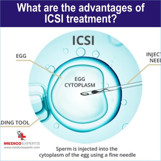 advantages of ICSI treatment icsi treatment india, ivf icsi treatment