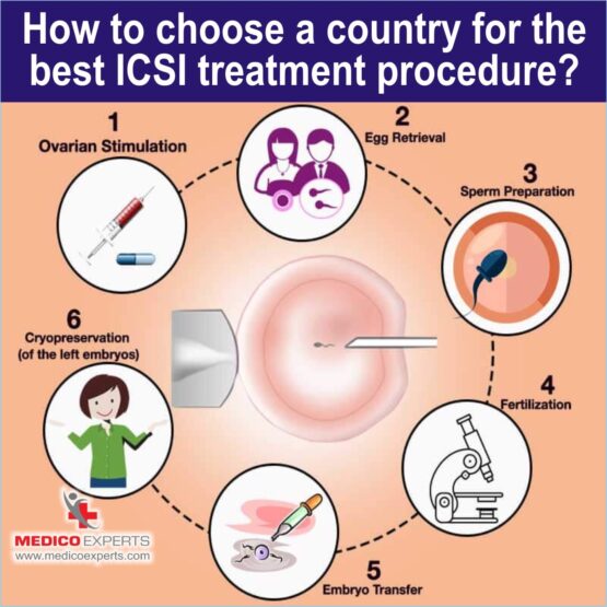 best country for ICSI Treatment ivf icsi treatment, icsi treatment procedure