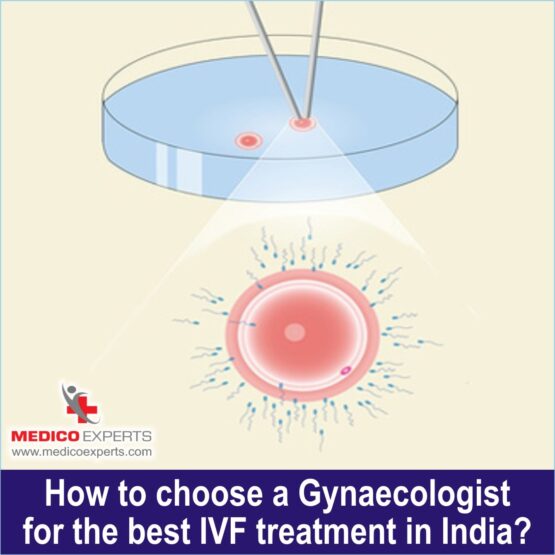best gynaecologist for IVF treatment, procedure of ivf treatment in india