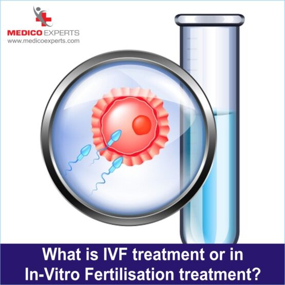 best ivf treatment in india, procedure of ivf treatment in india