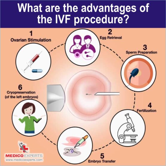 advantages of IVF treatment , ivf treatment in india