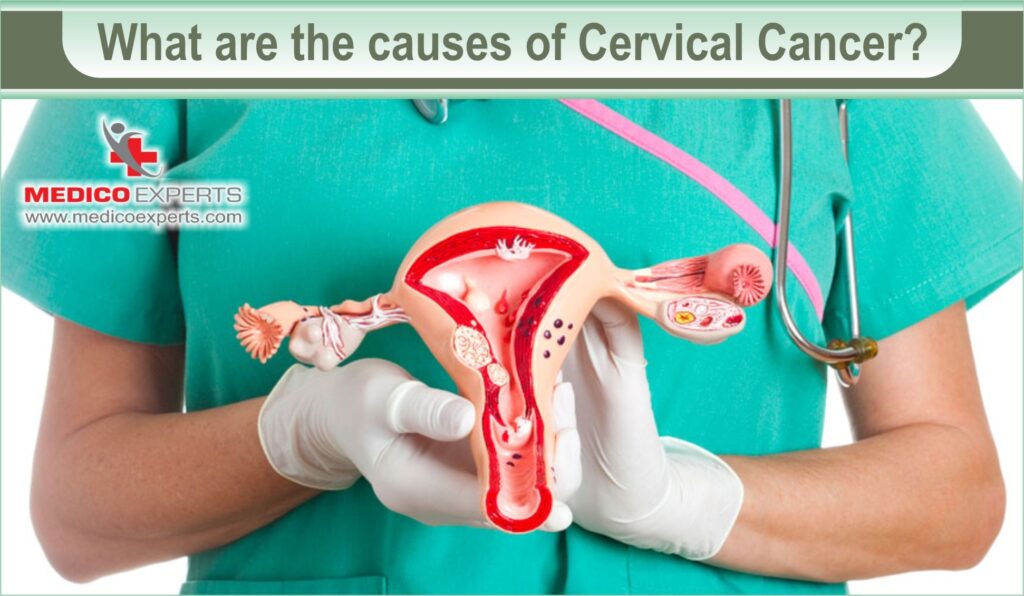 how i knew i had cervical cancer