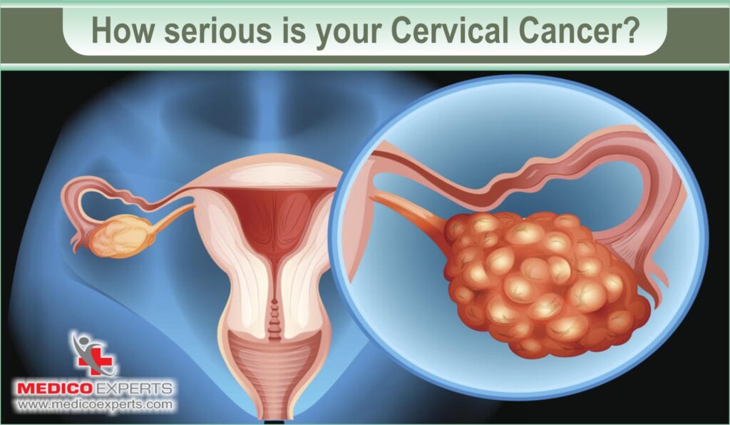 how i knew i had cervical cancer, visible signs of cervical cancer