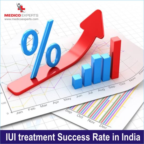 success rate of iui treatment