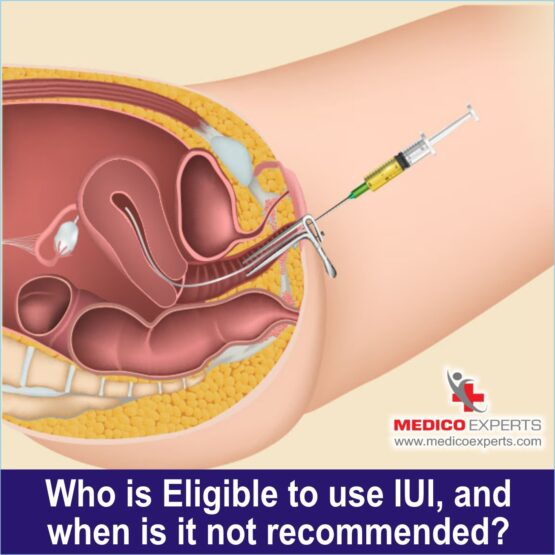 advanced iui treatment