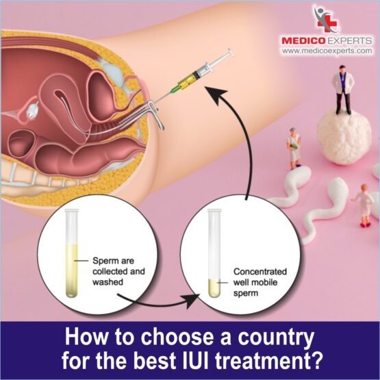 best country for iui treatment