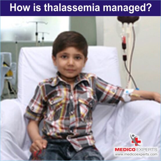 Thalassemia treatment in India without blood transfusion