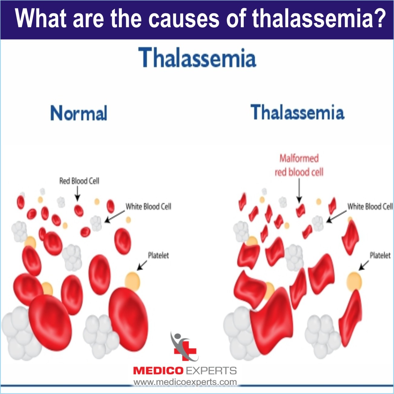 causes of thalassemia