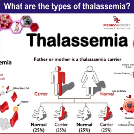 types of thalassemia, major thalassemia treatment
