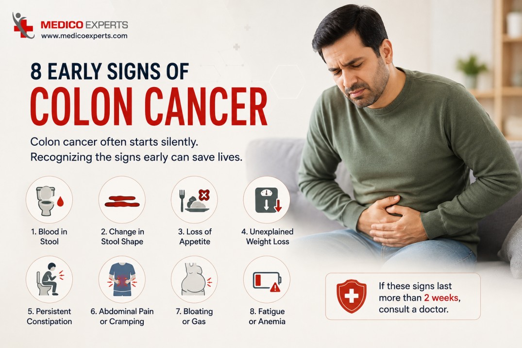 How I Knew I Had Colon Cancer: Early Signs and Pain Explained 8 How I Knew I Had Colon Cancer - 8 early signs of colon cancer