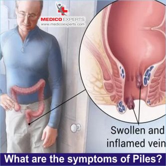 Symptoms of piles