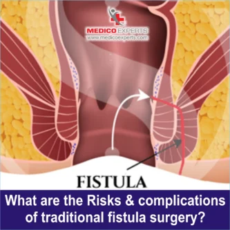 risks and complications of fistula fistula surgery