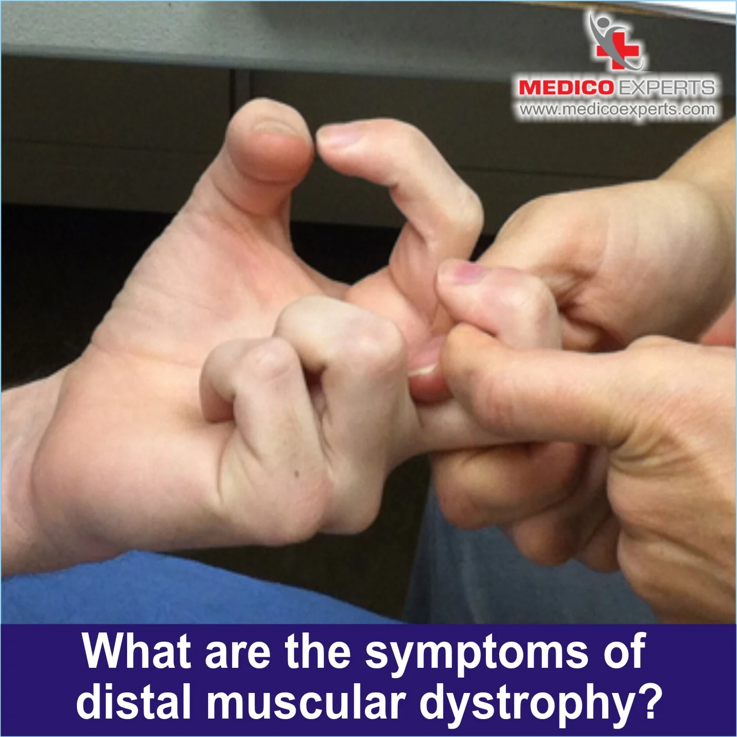 symptoms of Distal Muscular Dystrophy