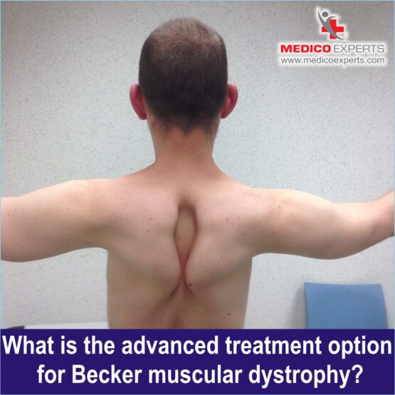 Treatment of becker's muscular dystrophy Treatment of becker's muscular dystrophy, Advanced becker's muscular dystrophy treatment in India