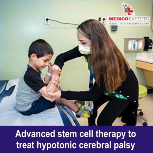 Advanced stem cell therapy to treat Hypotonic Cerebral Palsy