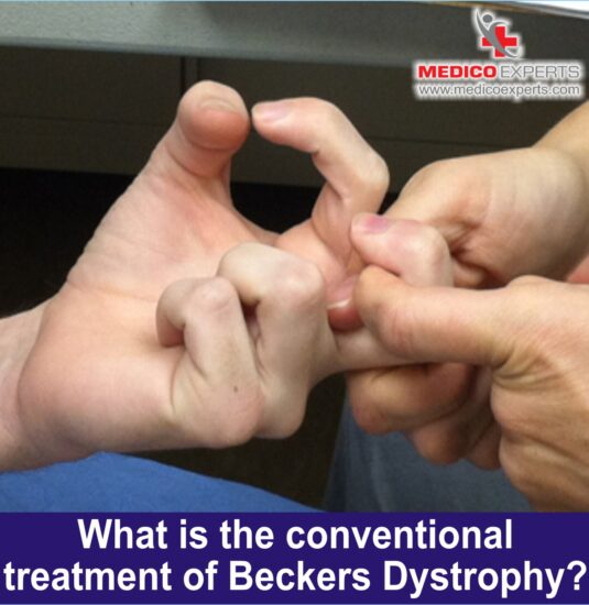 becker muscular dystrophy, becker muscular dystrophy treatment becker muscular dystrophy, becker muscular dystrophy treatment