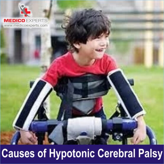Causes of Hypotonic Cerebral Palsy, stem cell treatment for Hypotonic Cerebral Palsy