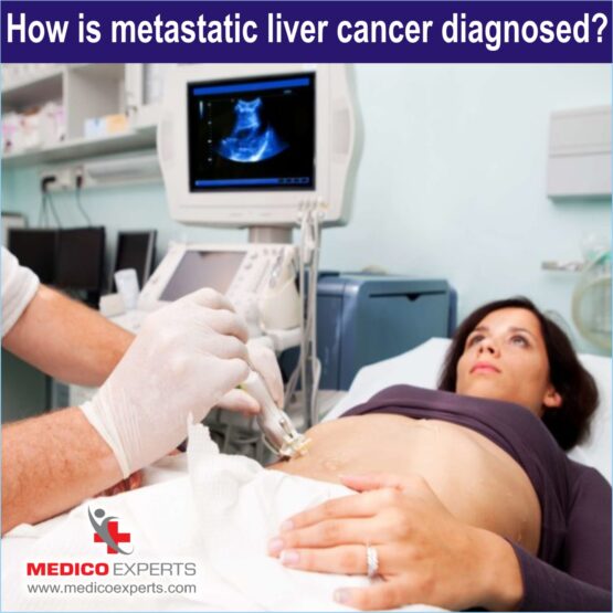 Diagnosis of Metastatic Liver Cancer Diagnosis of Metastatic Liver Cancer