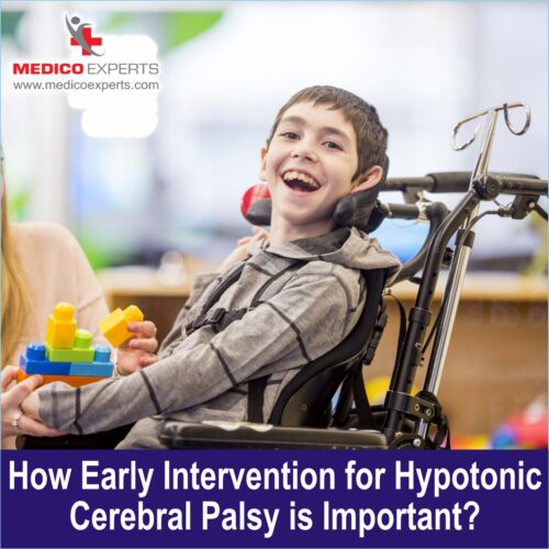 How Early Intervention for Hypotonic Cerebral Palsy