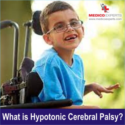 What is Hypotonic Cerebral Palsy