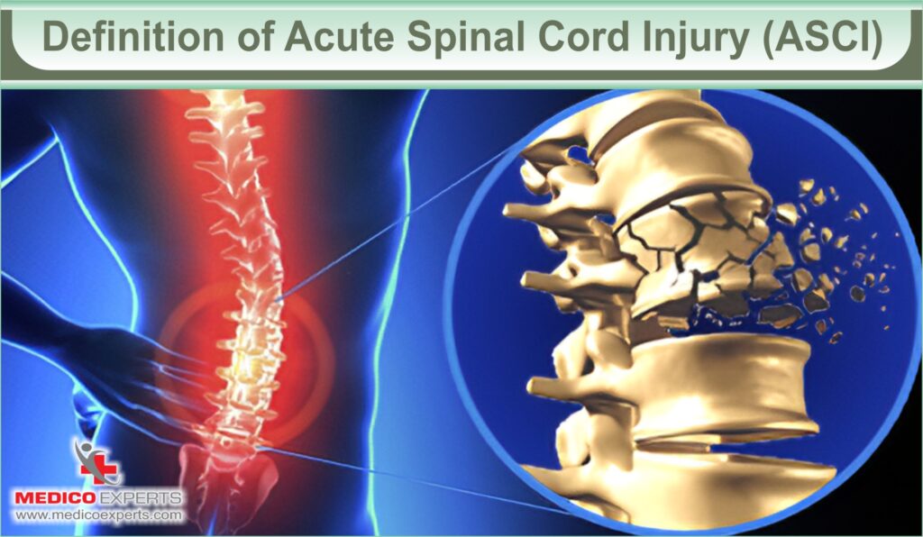 acute spinal cord injury treatment