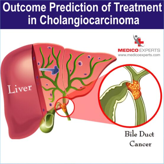 Bile Duct Cancer treatment in india