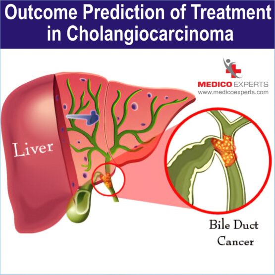 Bile Duct Cancer treatment in india Bile Duct Cancer treatment in india