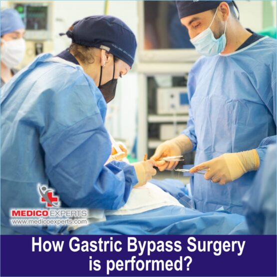 Gastric Bypass Surgery Gastric Bypass Surgery