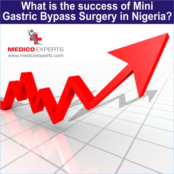 success rate of Mini Gastric Bypass Surgery success rate of Mini Gastric Bypass Surgery