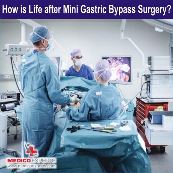 Mini Gastric Bypass Surgery Mini Gastric Bypass Surgery