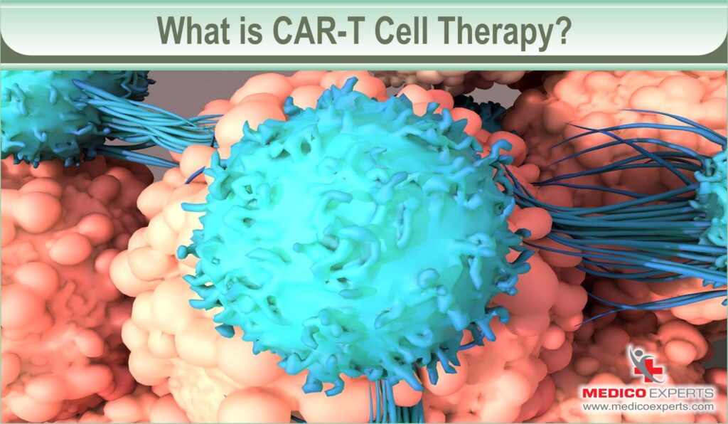 car t-cell therapy india