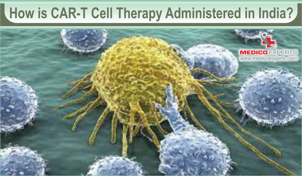car t-cell therapy, car t-cell therapy in india