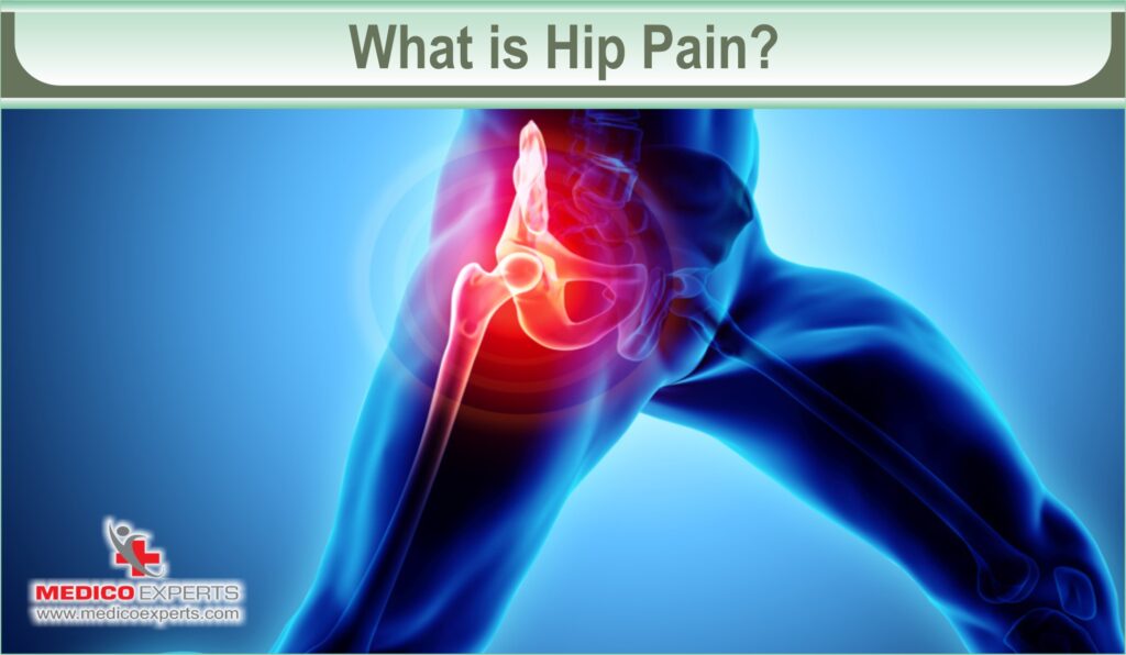hip pain exercise