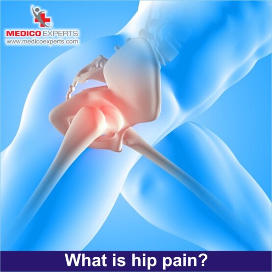 what is hip pain?