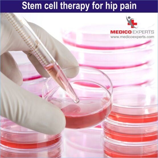 stem cell for hip pain
