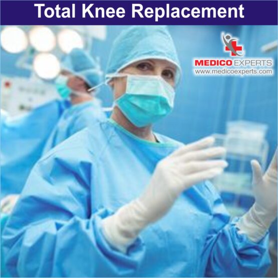 total knee replacement