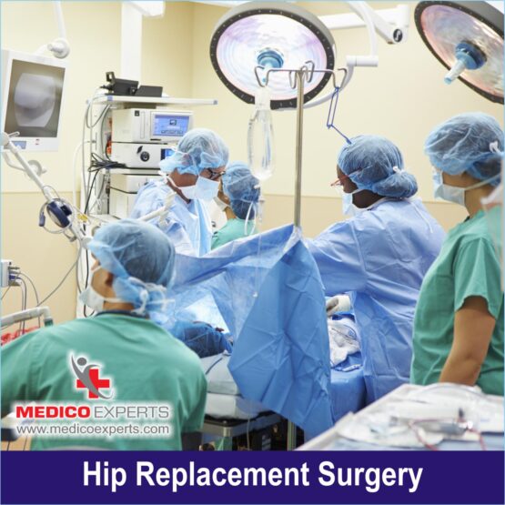 hip replacement