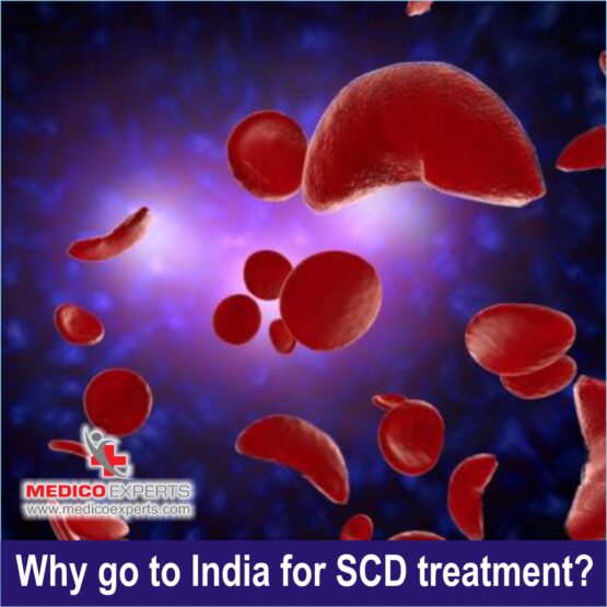 Sickle Cell Disease Sickle Cell Disease