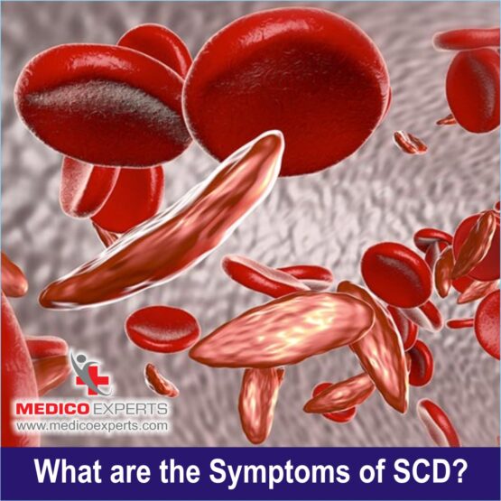 Symptosm Sickle Cell Disease Symptoms Sickle Cell Disease