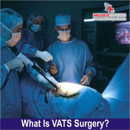 VATS Surgery in India