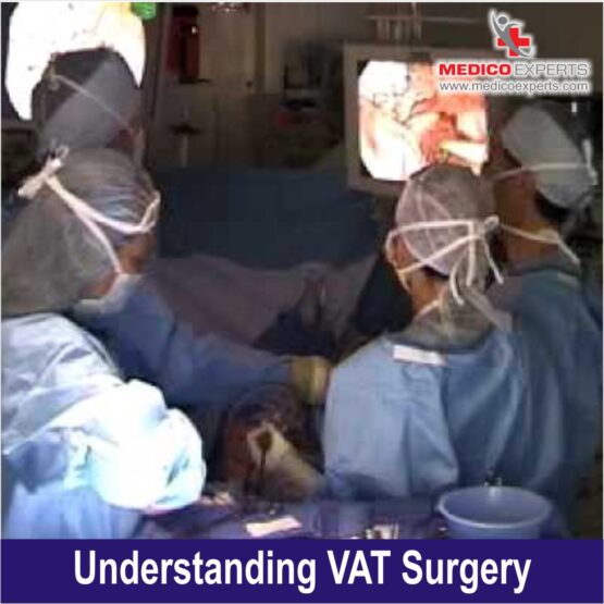 VATS Surgery