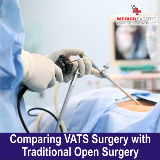 VATS Surgery