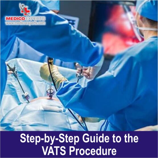 VATS Surgery