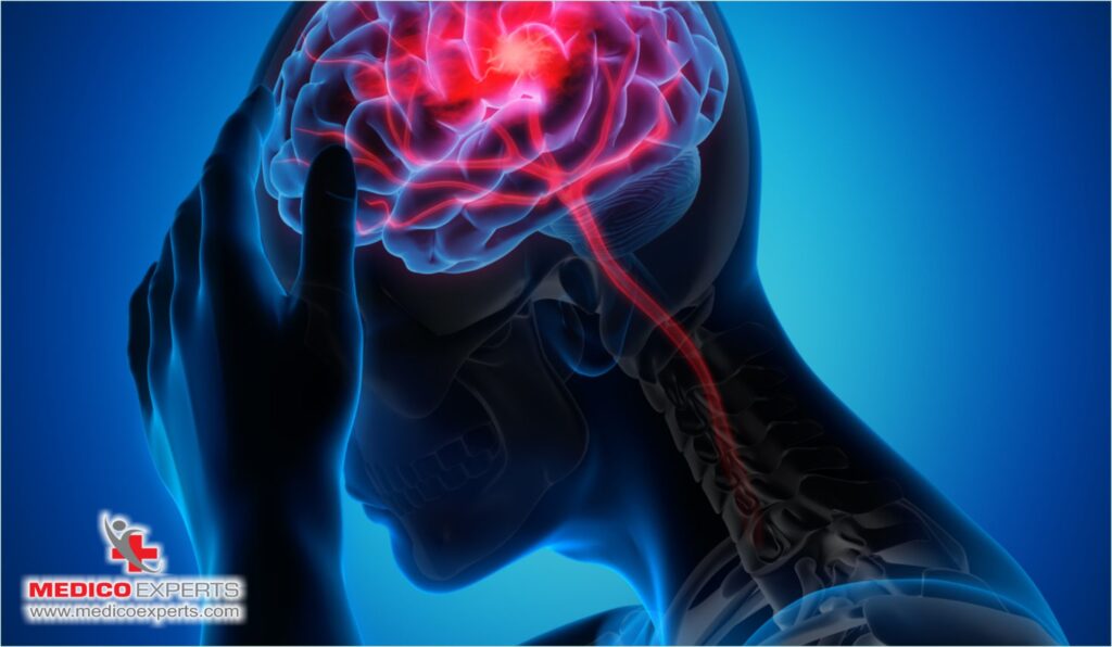 Motor Neuron Disease Treatment In India: Advanced Options & Combination Therapy 6 How stem cell treatment can help in motor neuron disease?, treatment of motor neuron disease, Stem cell treatment for motor neuron disease, What is the latest treatment for motor neuron disease?