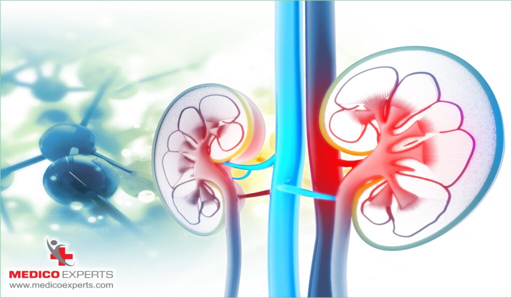 What is the Treatment for Increased Echogenicity of the Kidneys? 3 what is the treatment for increased echogenicity of the kidneys?, what is the treatment for increased echogenicity of the kidneys in adults, mild increased echogenicity of the kidneys, What causes an increase in echogenicity in the kidneys?, Are echogenic kidneys serious?